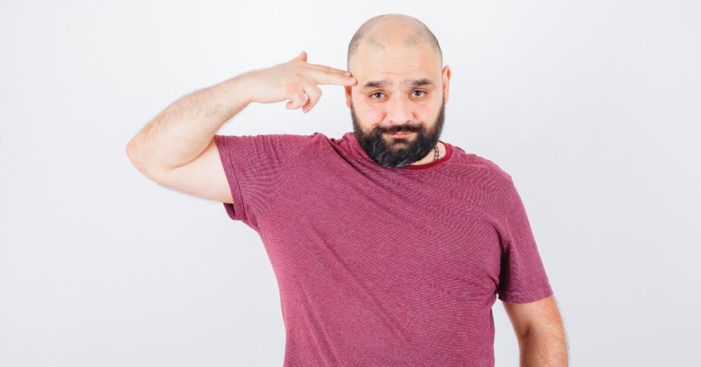 Losing Hair Buzz Cut